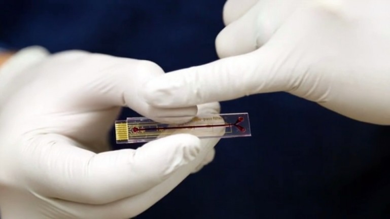 Электронный имплантат измерения пропорций лекарства  в крови 
