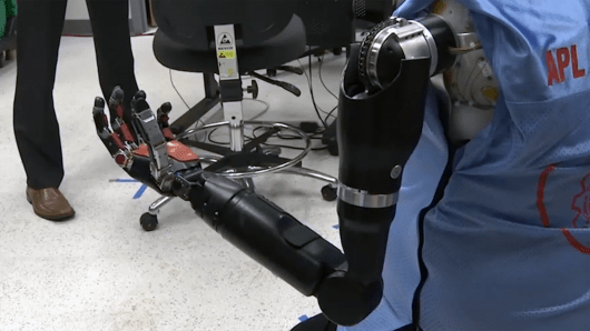 double-amputee-mind-controlled-prosthetics-1